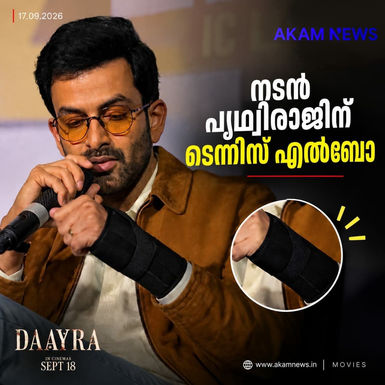 നടൻ പൃഥ്വിരാജിന് ടെന്നിസ് എൽബോ